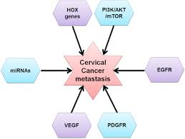Cancer growth cells may have spread to the lower some portion of the vagina. Cervical Cancer Metastasis Sciencedirect