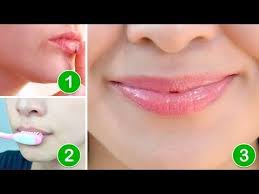 How To Get Pink Lips Lighten Dark Lips Naturally At Home Get Rid Of Chapped Lips Youtube Lip Lightening Dark Lips Pink Lips