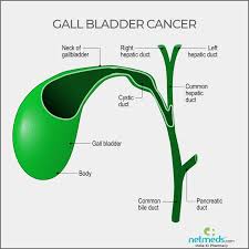 Maybe you would like to learn more about one of these? Gall Bladder Cancer Causes Symptoms And Treatment