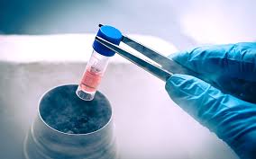 This is expressed as the number of viral particles in each milliliter of blood. Viral Vector Production Unit Upv