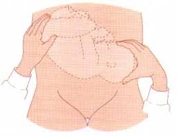 I Am Currently 32 Weeks With My Second Baby And He S Moved Into A Transverse Position My Midwife Isn T Optimistic About The Chances Of Him Moving Head Down As He Is Quite