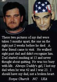 Whyquit S Family Tobacco Victims Too Young To Die
