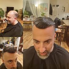 Maybe you would like to learn more about one of these? The Reason For Why Male Pattern Baldness Reddit Information Is So Important