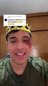 Respuesta divertida sobre lentejas en vivo