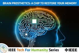 Brain Prosthetics: A Chip To Restore Your Memory | Sxsw 2016 Event Schedule