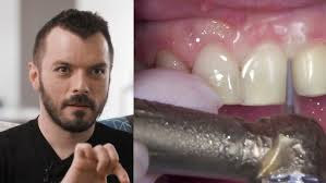 Dentcof Masterclass: RAW course