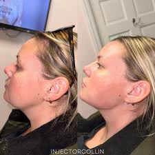 We're giving angles, we're giving cutting glass with the sharpness, we're  giving snatched!!! 📐A little jawline to start off the day at the UES!