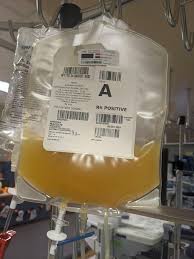 Image result for Platelet Transfusion