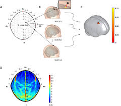 In malaysia, adjudication may only be commenced by the person who claims to be entitled to progress payments. Transcranial Brain Atlas Science Advances