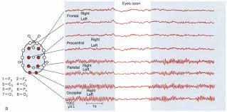 Image result for Higher Integrative Function