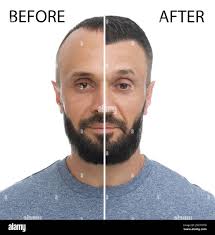 Beard before after immagini e fotografie stock ad alta risoluzione