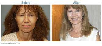 Wolf's Rejuvenation Center, 1 Marty Ln, West Alexandria, OH 45381, US