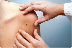 According to the cleveland clinic health essentials, the skin condition idiopathic guttate hypomelanosis can cause multiple small, scattered, smooth white spots (about 2 to 6 mm in size) to appear on skin that&#x27;s been exposed to the sun.these pesky white spots most often appear on the face, neck, hands, and arms. Skin Cancer Symptoms