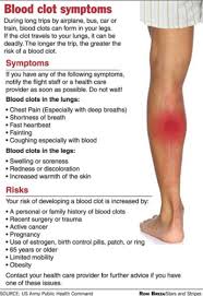 Signs and symptoms of a blood clot in a person's lung may include: Understanding The Symptoms Of A Blood Clot Biggies Boxers