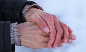 Image result for Dry Skin