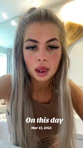 #onthisday #fyp #georgiafox #turkeyteeth