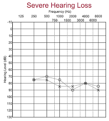 what is an audiogram understanding hearing test results