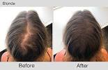 How To Get Rid Of Hair Part In Back Of Head