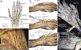 In mycology, anastomosis is the fusion between branches of the same or different hyphae. Neural Interconnections Between The Nerves Of The Upper Limb And Surgical Implications In Journal Of Neurosurgery Volume 114 Issue 1 2011