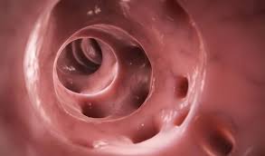Diverticules Et Diverticulite Causes Symptomes Et Traitements Passionsante Be