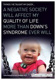 Stay Positive Down Syndrome Quotes Down Syndrome Kids Syndrome Quotes
