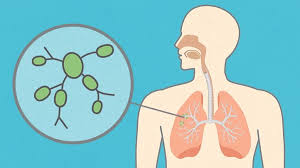 You may need a nuclear scan before your procedure. Questions About Lymph Nodes Everyday Health