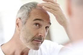 You just need a style that complements it and you are out to have fun. Hairstyle Options For A Receding Hairline 18 8 Men S Salon Carmel