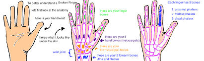 The proximal phalanx (pp) of the fingers is fractured more frequently than the middle or even distal phalanges. Broken Finger Phalanx Fracture Bone Talks