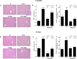 Check spelling or type a new query. Metformin Attenuates The Onset Of Non Alcoholic Fatty Liver Disease And Affects Intestinal Microbiota And Barrier In Small Intestine Scientific Reports