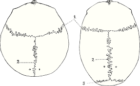 It is continuous with the occipitomastoid suture. Bregma Wikipedia
