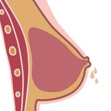 Image result for Galactorrhea