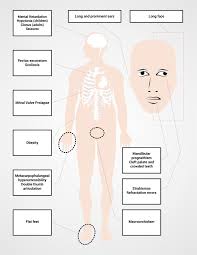 View Of Fragile X Syndrome Colombia Medica