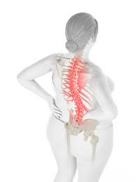 Relâchement du bas du dos en position allongée : Surpoids Obesite Mal De Dos Quand Les Kilos Pesent Sur Mon Dos