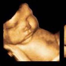 Baby Belly Pregnancy Spa Imaging Center Diagnostic Imaging 201 Ruccio Way Lexington Ky Phone Number