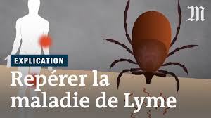 Fr compositions combinees pour le traitement de la maladie de lyme et leur utilisation. Maladie De Lyme Comment La Reperer Youtube