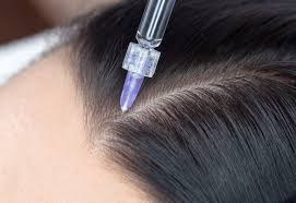 This is more likely if you have had higher doses of radiotherapy. Taxotere Side Effects Unique Permanent Hair Loss Risk