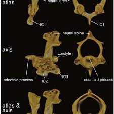 C1, c2 (atlas, axis) parts: Atlas And Axis Of Ablepharus Kitaibelii The Atlas Is A Slender Ring Download Scientific Diagram