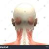 Back pain is common and might be caused by a problem with a muscle. 1