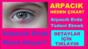 1 gecede evde arpacik nasil gecer evde uygulayacaginiz tum pratik yontemler bu videoda youtube