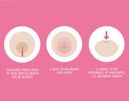 If you have a disease how can i lower my risk of breast cancer? Breast Cancer Signs Baby Saved Mum After Finding Cancerous Lump While Breastfeeding Express Co Uk