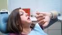 Dents de sagesse : faut-il les enlever? - m