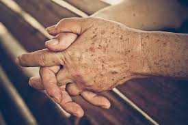 So what should you do if you've noticed that your hands are looking older than you'd like? What Can Make My Hands Look Younger The Vein Center Of Maryland