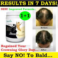 At best, there seems to be a correlation between hair loss and specific types of protein shakes that contain added ingredients for weight, muscle, and dietary management. Biovita Sesame Protein Improves Hair Growth Prevent Thinning 450g Halal Organic Shopee Malaysia