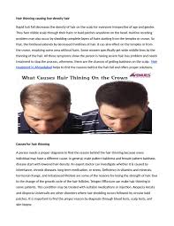 Hair loss, also known as alopecia or baldness, refers to a loss of hair from part of the head or body. What Causes Hair Thining On The Crown By Avenues Cosmetic Issuu
