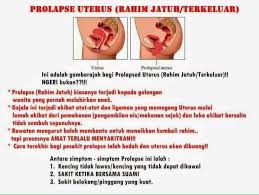 Alat ini memiliki peranan yang besar dalam reproduksi wanita. Stokis Jamu Susuk Dara Kluang Taman Sri Lambak 2021