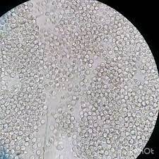 53 Me Gusta 4 Comentarios Eumidiauris Eumidiauris En Instagram Sedimento Urinario Incontables Leucocitos Orina Plates Tableware Kitchen