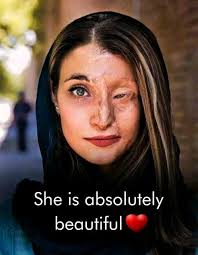 In case you haven't chanced