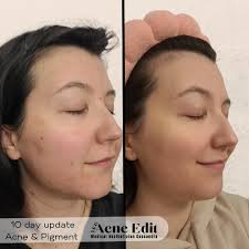 Cassandra Ness's Instagram, Twitter & Facebook