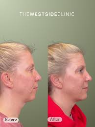 Happy National Selife Day! Today, we're celebrating the fierce, fabulous,  and flawless patients of The Westside Clinic. You're the reason beauty  walks through our doors every day—and we're obsessed. Thank you for