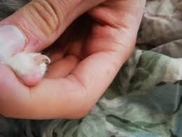 We did not find results for: Black Spots In My Cats Claws Cut Claws Thecatsite